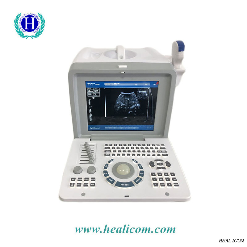 Equipo médico escáner de ultrasonido de modo portátil ultrasónico HBW-2