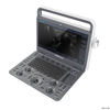 SonoScape E2 Professional Hospital utiliza un sistema de diagnóstico de máquina de ultrasonido Doppler color digital completo