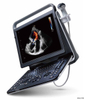 Sistema de diagnóstico HUC-590 Ecógrafo digital portátil Doppler color 3D 4D Sistema de diagnóstico HUC-590 Ecógrafo digital portátil Doppler color 3D 4D