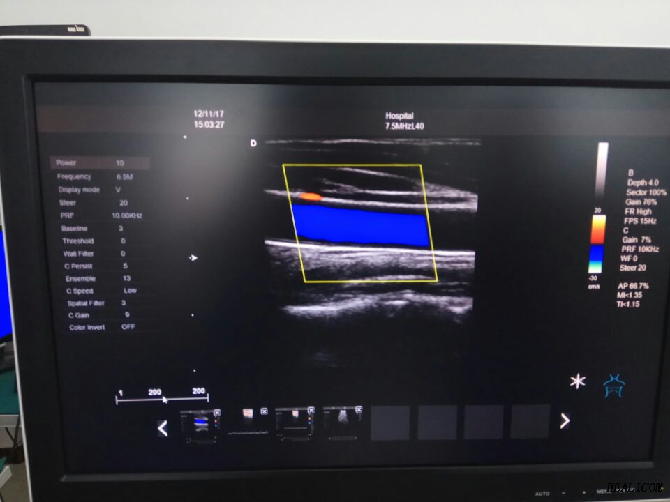 Equipo médico HUC-600P Escáner de ultrasonido Doppler color 4D tipo carro digital completo